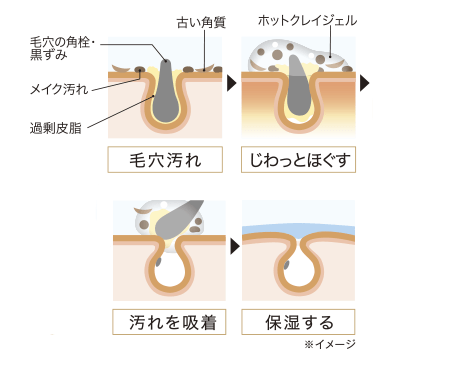 クッションジェルで根こそぎ吸着汚れが詰まりにくい肌へ。